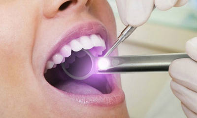 McClane Dentistry 3 oral cancer 400x241 1